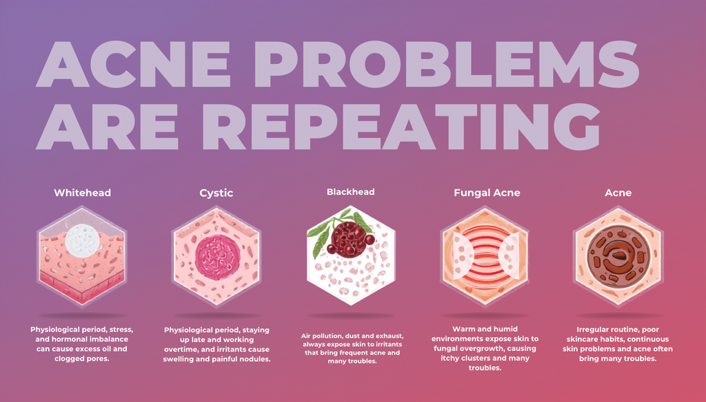 Infographic on acne types with illustrations and text on a pink background